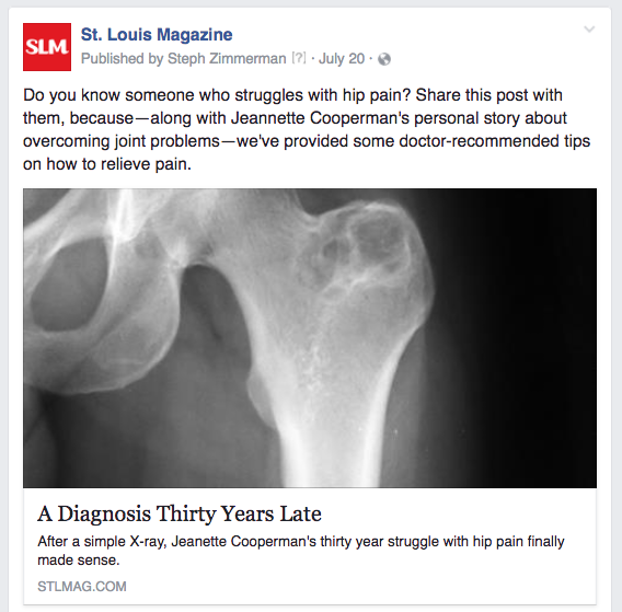 STL hip pain